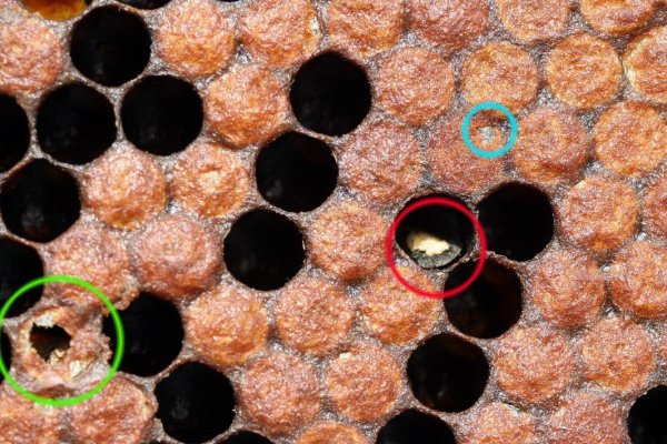 Covata calcificata.JPG